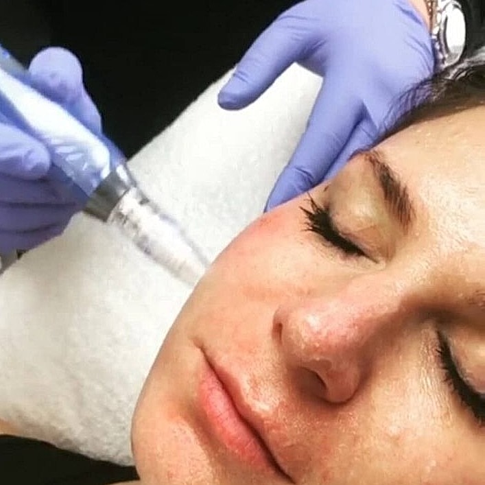 Medical Aesthetics Training To Address Skincare Concerns Of Patients